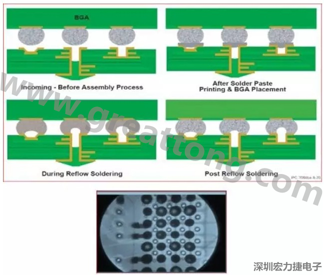 PCBA DFM问题实例6： BGA焊盘底下Via风险